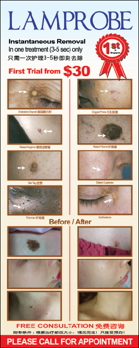 1408001_Christie Beauty_Catherine_Before & After Treatment Roll Up_revised