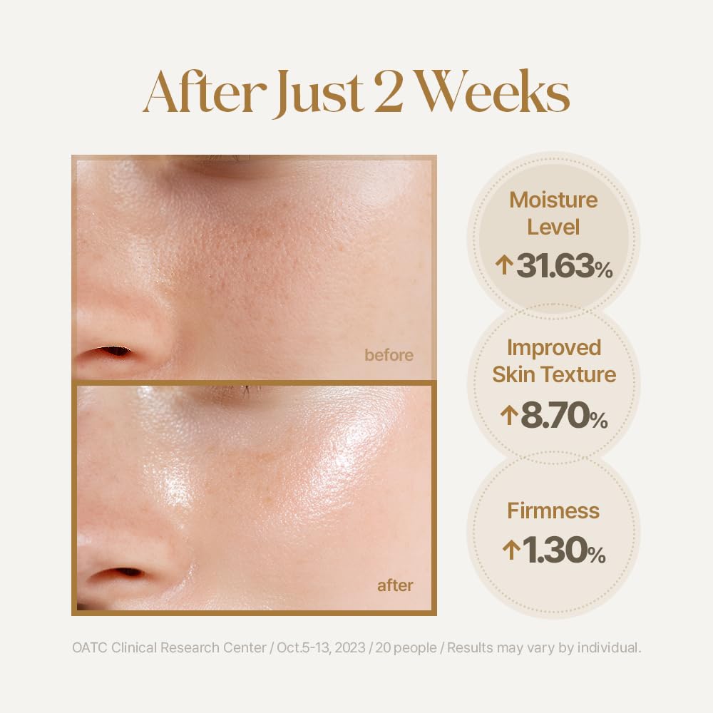 51-HwDplZHL._SL1000_